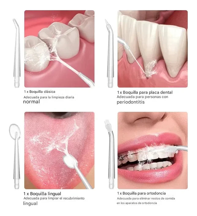 Irrigador Bucal Portátil – Limpieza Dental Profunda