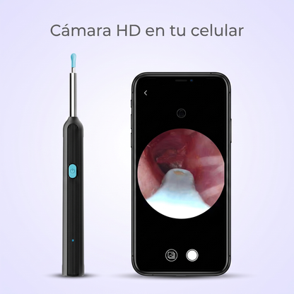 Otoscopio con cámara HD conectado al celular mostrando el oído en tiempo real
